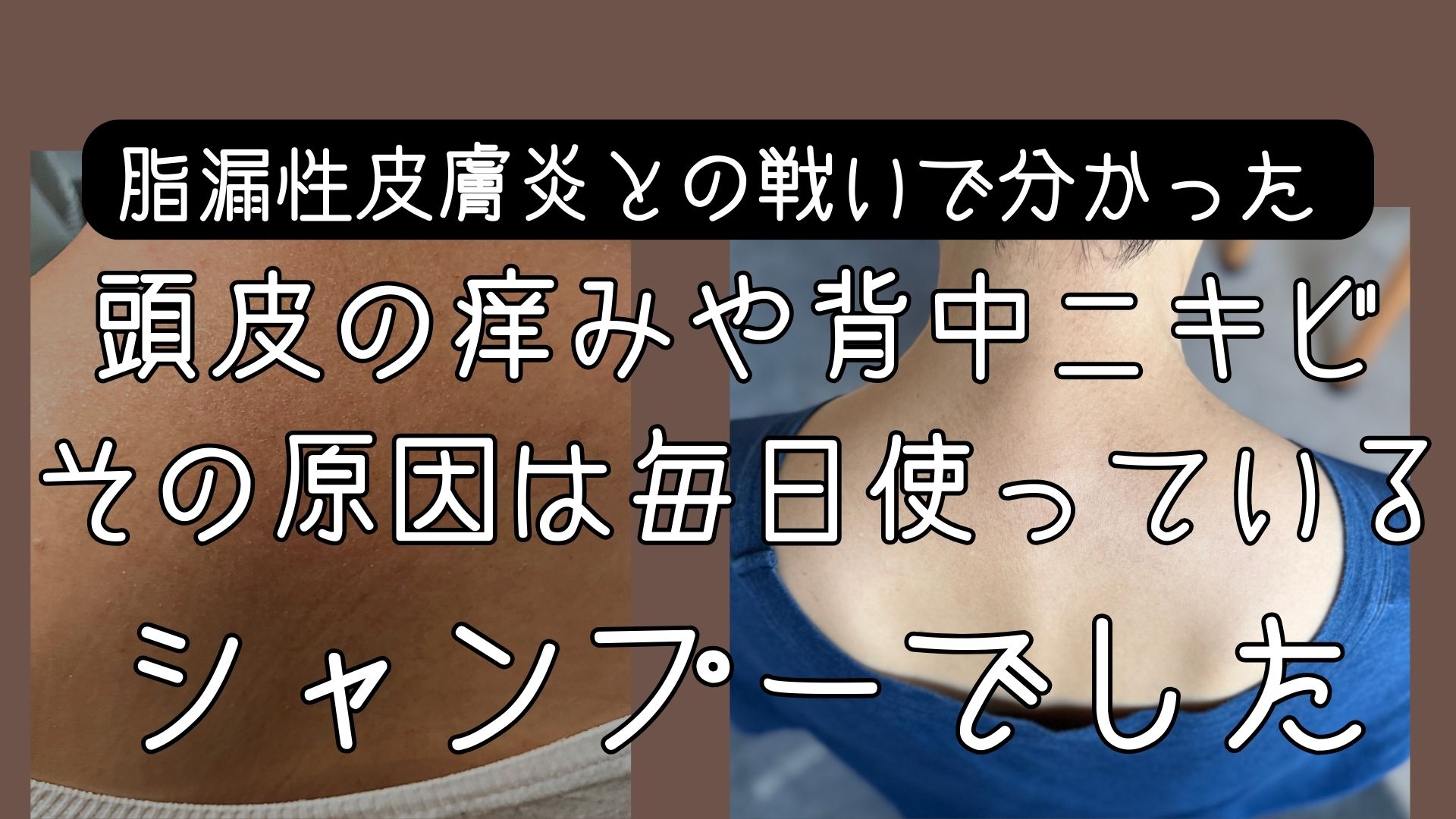 入浴前にボディブラシで脚をドライブラッシングする欧米人女性 タイトル： ドライブラッシング - 欧米式ボディブラシの使い方