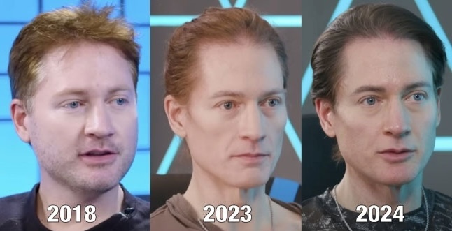 アンチエイジングに年間約3億円を費やすアメリカの起業家ブライアン・ジョンソン氏の2018年、2023年、2024年の顔の変化を並べた比較写真