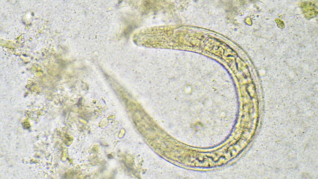 顕微鏡で見た糞線虫（Strongyloides stercoralis）の拡大画像